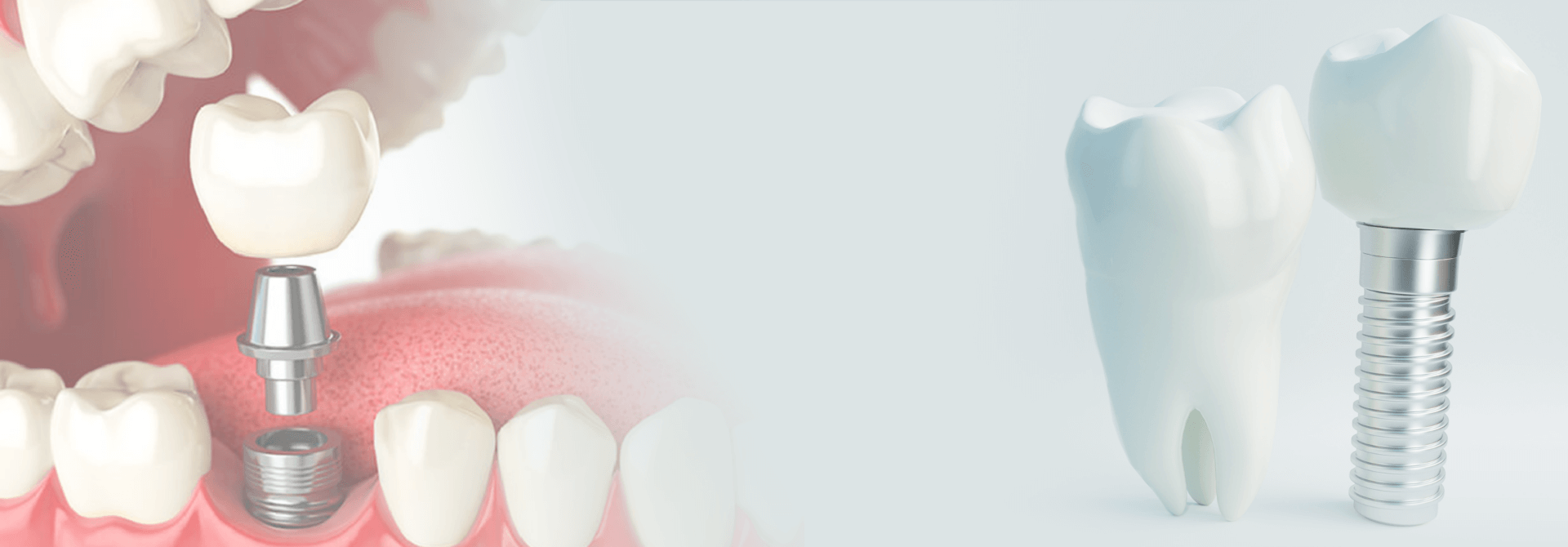 名古屋ウィズ歯科矯正歯科