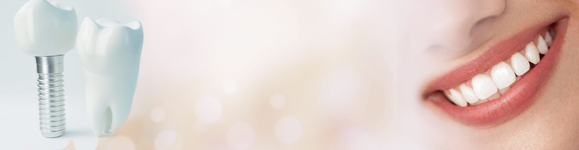 歯列矯正の種類