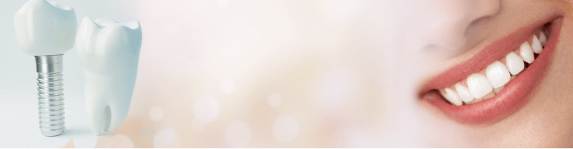 歯列矯正の種類